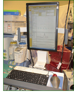 Figfure 2. Anesthesia Information Management System Work Station at Santa Clara Valley Medical Center