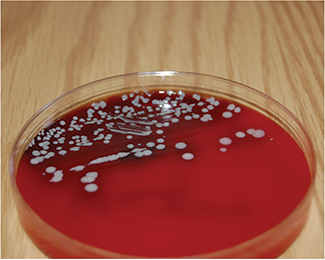 Bacteria cultured from unprotected IV port.